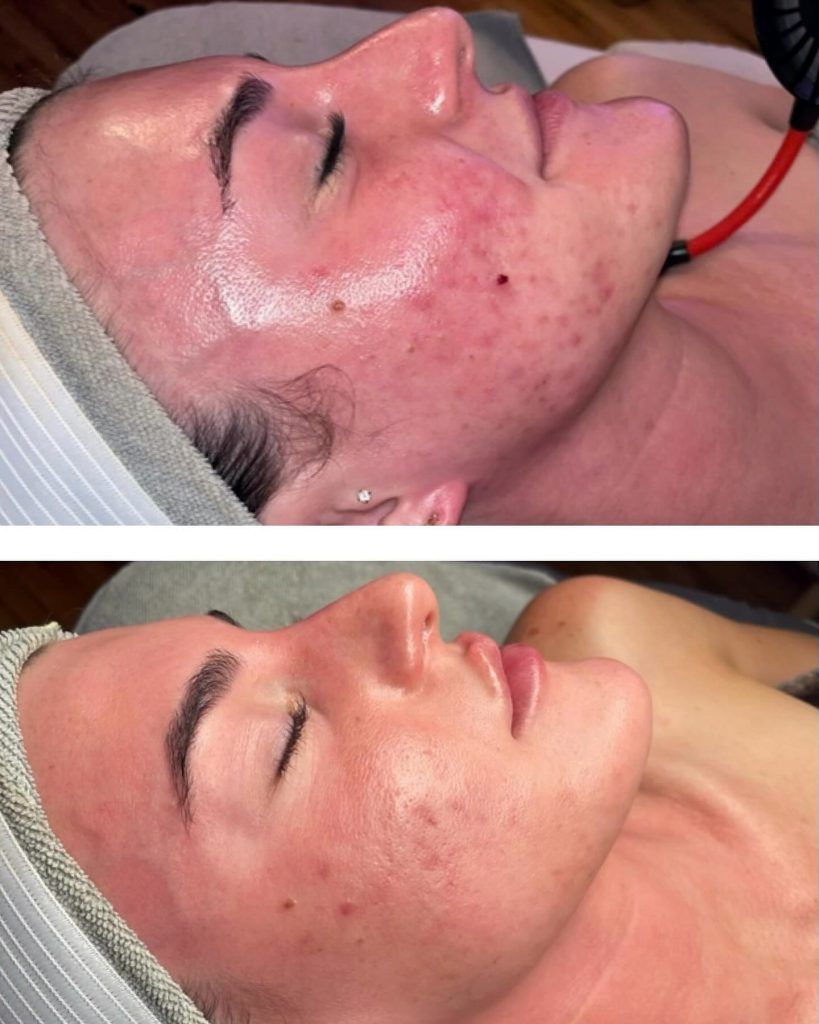 Custom Skincare and facial services at Lavish Scranton